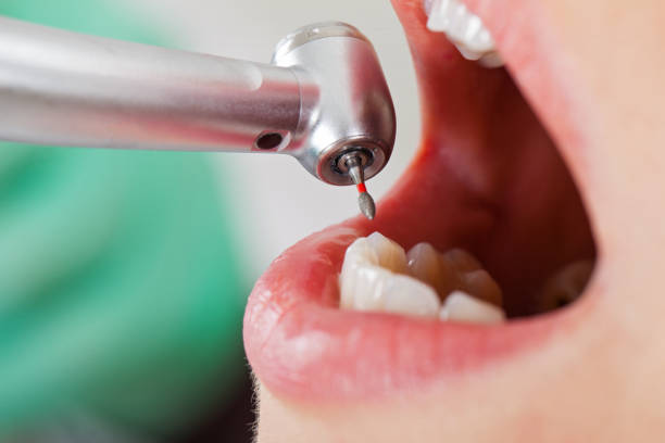 Best Emergency Root Canal Treatment in Vineyard Haven, MA